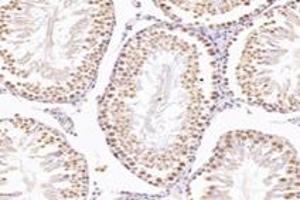 Immunohistochemistry (Paraffin-embedded Sections) (IHC (p)) image for anti-Nudix (Nucleoside Diphosphate Linked Moiety X)-Type Motif 22 (NUDT22) antibody (ABIN7074928)