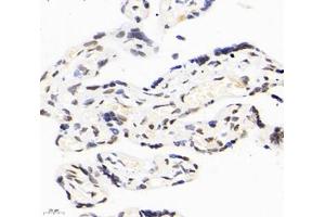 Immunohistochemistry analysis of paraffin-embedded human placenta using,RBM14 (ABIN7075474) at dilution of 1: 2000