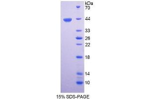SDS-PAGE (SDS) image for Chitobiase, Di-N-Acetyl (CTBS) (AA 47-385) protein (His tag) (ABIN4990793)