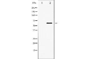 Western blot analysis of PDK1 expression in EGF treated MDA-MB-435 whole cell lysates,The lane on the left is treated with the antigen-specific peptide. (PDPK1 抗体  (Internal Region))