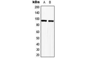 Western blot analysis of TLE2 expression in HeLa (A), Jurkat (B) whole cell lysates. (TLE2 抗体  (Center))