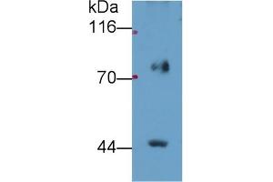 Detection of FADS2 in Porcine Lung lysate using Polyclonal Antibody to Fatty Acid Desaturase 2 (FADS2) (FADS2 抗体  (AA 1-130))