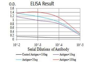 Black line: Control Antigen (100 ng), Purple line: Antigen(10 ng), Blue line: Antigen (50 ng), Red line: Antigen (100 ng), (Histone Cluster 2, H3c (HIST2H3C) (acLys27) 抗体)