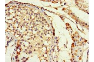 Immunohistochemistry of paraffin-embedded human testis tissue using ABIN7155679 at dilution of 1:100 (DLX5 抗体  (AA 1-249))