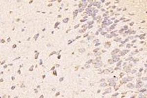 Immunohistochemistry analysis of paraffin-embedded mouse striatum using,TTL (ABIN7076048) at dilution of 1: 4000 (TTL 抗体)