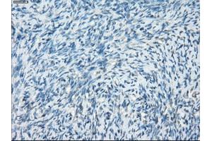 Immunohistochemistry (IHC) image for anti-Protein Kinase, CAMP-Dependent, Regulatory, Type I, alpha (Tissue Specific Extinguisher 1) (PRKAR1A) antibody (ABIN2729578)