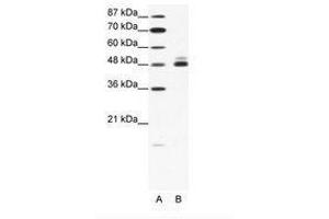 Image no. 1 for anti-Cholinergic Receptor, Nicotinic, beta 2 (Neuronal) (CHRNB2) (AA 21-70) antibody (ABIN202670) (CHRNB2 抗体  (AA 21-70))