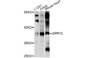 Western blot analysis of extracts of various cell lines, using SPRY2 antibody (ABIN6293587) at 1:1000 dilution. (SPRY2 抗体)