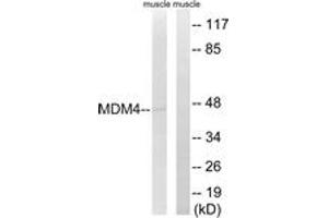 Western blot analysis of extracts from rat muscle cells, using MDM4 (Ab-367) Antibody. (MDM4-binding Protein 抗体  (AA 336-385))