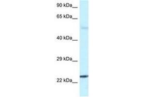 Image no. 1 for anti-RAB31, Member RAS Oncogene Family (RAB31) (C-Term) antibody (ABIN6747504) (RAB31 抗体  (C-Term))