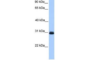 WB Suggested Anti-HAGH Antibody Titration: 0. (HAGH 抗体  (C-Term))