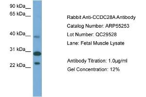 CCDC28A 抗体  (Middle Region)