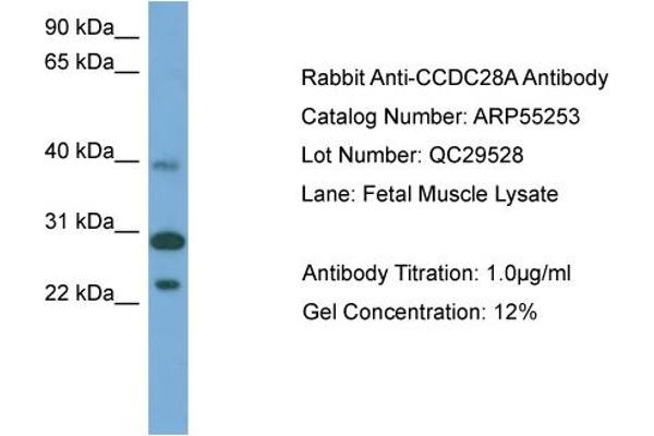 CCDC28A 抗体  (Middle Region)
