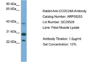 WB Suggested Anti-CCDC28A  Antibody Titration: 0.