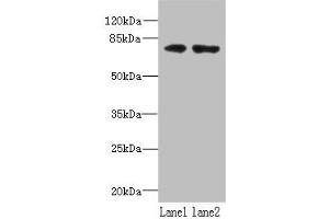 Western blot All lanes: WDTC1 antibody at 1. (WDTC1 抗体  (AA 201-420))
