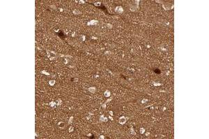 Immunohistochemical staining of human cerebral cortex with SDCCAG1 polyclonal antibody  shows strong nuclear and cytoplasmic positivity in neuronal cells.
