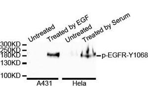 Western blot analysis of extracts of various cell lines, using Phospho-EGFR-Y1068 antibody. (EGFR 抗体  (pTyr1092))