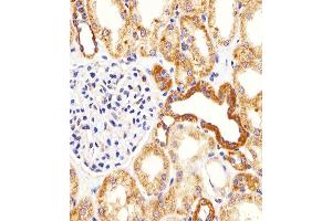 Immunohistochemical analysis of paraffin-embedded H. (BIM 抗体  (AA 134-160))