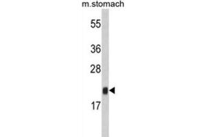 Western Blotting (WB) image for anti-FK506 Binding Protein 11, 19 KDa (FKBP11) antibody (ABIN3002801) (FKBP11 抗体)