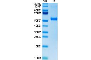 SDS-PAGE (SDS) image for delta Like Protein 3 (DLL3) (AA 27-490) protein (His tag,Biotin) (ABIN7274483)