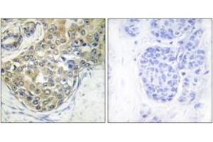 Immunohistochemistry (IHC) image for anti-tyrosine Kinase, Non-Receptor, 2 (TNK2) (AA 250-299), (pTyr284) antibody (ABIN1531417)