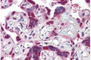 Placenta, Human: Formalin-Fixed, Paraffin-Embedded (FFPE) (DNAJB1 抗体)