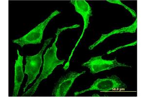 Immunofluorescence of monoclonal antibody to GALNT1 on HeLa cell. (Galnt1 抗体  (AA 42-123))