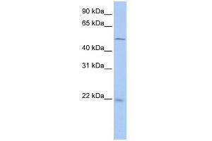 WB Suggested Anti-SDCBP2 Antibody Titration: 0. (SDCBP2 抗体  (N-Term))