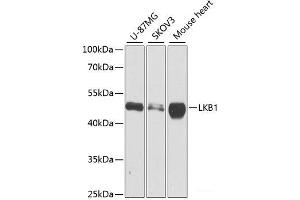 Western blot analysis of extracts of various cell lines using LKB1 Polyclonal Antibody at dilution of 1:1000. (LKB1 抗体)
