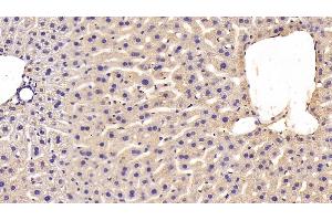 Detection of MT2 in Mouse Liver Tissue using Polyclonal Antibody to Metallothionein 2 (MT2) (MT2 抗体  (AA 2-61))