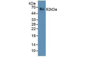 WB analysis of recombinant Human PRF1 Protein, using Rabbit anti-Human PRF1 antibody (abx100625). (Perforin 1 蛋白)