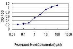 Detection limit for recombinant GST tagged N4BP2 is approximately 0. (N4BP2 抗体  (AA 1671-1770))