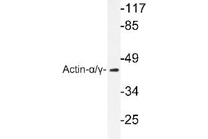 Image no. 2 for anti-Actin (pan) antibody (ABIN271986) (Actin 抗体  (pan))
