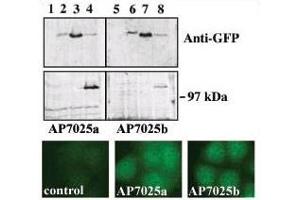 Upper panel, western blot analysis of GFP fusion protein expression in Panc-1 cells by using an anti-GFP antibody. (PRKD3 抗体  (C-Term))