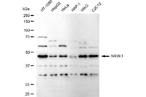 Western blotting analysis using NR2E1 antibody (ABIN7799654).