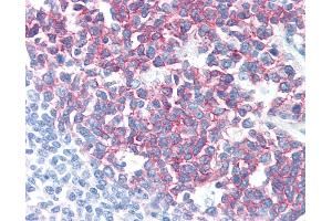 Anti-PAG1 / PAG antibody IHC of human tonsil. (PAG1 抗体  (C-Term))