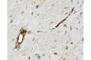 IHC analysis of MSN using anti-MSN antibody (ABIN7600378). (Moesin 抗体  (AA 184-568))