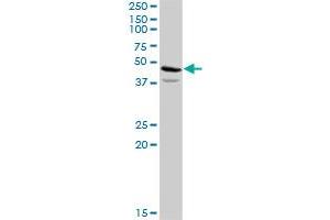 ACAT2 MaxPab rabbit polyclonal antibody. (ACAT2 抗体  (AA 1-397))