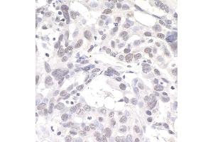 anti-DNA Kinase/phosphatase Pnk1 (PNK1) (AA 100-150) antibody