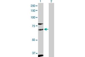 Western Blotting (WB) image for anti-FYN Oncogene Related To SRC, FGR, YES (FYN) (AA 1-537) antibody (ABIN515873)