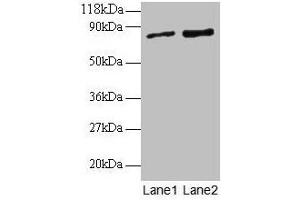Western blot All lanes: RAB1A antibody at 2 μg/mL Lane 1: EC109 whole cell lysate Lane 2: 293T whole cell lysate Secondary Goat polyclonal to rabbit IgG at 1/15000 dilution Predicted band size: 23, 16, 14 kDa Observed band size: 80 kDa (RAB1A 抗体  (AA 2-205))