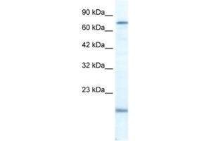 Western Blotting (WB) image for anti-PiggyBac Transposable Element Derived 3 (PGBD3) antibody (ABIN2461365) (PGBD3 抗体)