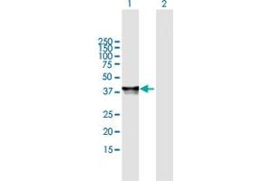 Western Blot analysis of PHF20L1 expression in transfected 293T cell line by PHF20L1 MaxPab polyclonal antibody. (PHF20L1 抗体  (AA 1-285))