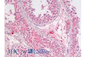 ABIN6391386 (5µg/ml) staining of paraffin embedded Human Testis. (SGTA 抗体  (AA 84-97))