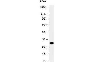 Western blot testing of Aquaporin 8 antibody and A431 cell lysate. (Aquaporin 8 抗体  (N-Term))