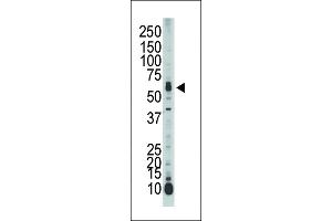 Western Blotting (WB) image for anti-serine threonine Kinase 39 (STK39) (AA 346-376) antibody (ABIN392497)