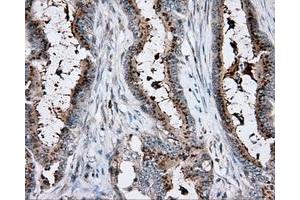 Immunohistochemical staining of paraffin-embedded pancreas tissue using anti-RC200180 mouse monoclonal antibody. (KCTD5 抗体)