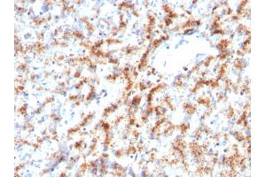 Formalin-fixed, paraffin-embedded human Liver stained with Cathepsin D Mouse Monoclonal Antibody (CTSD/3082).