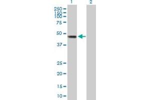Western Blot analysis of SMYD2 expression in transfected 293T cell line by SMYD2 MaxPab polyclonal antibody. (SMYD2A 抗体  (AA 1-433))