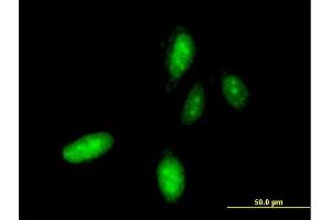 Immunofluorescence of monoclonal antibody to HOXC10 on HeLa cell. (HOXC10 抗体  (AA 158-257))
